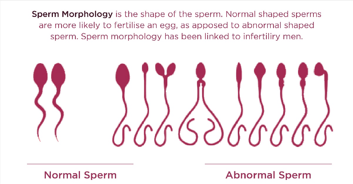 What Do Fertility Centres Near Me Services Include? thumbnail