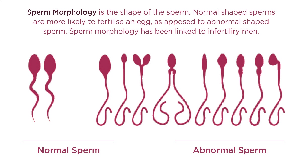 What Is The Best Best Fertility Centers?