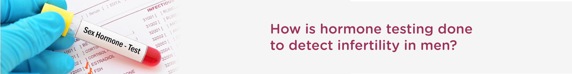 How is Hormone Testing Done to Detect Infertility in Men?