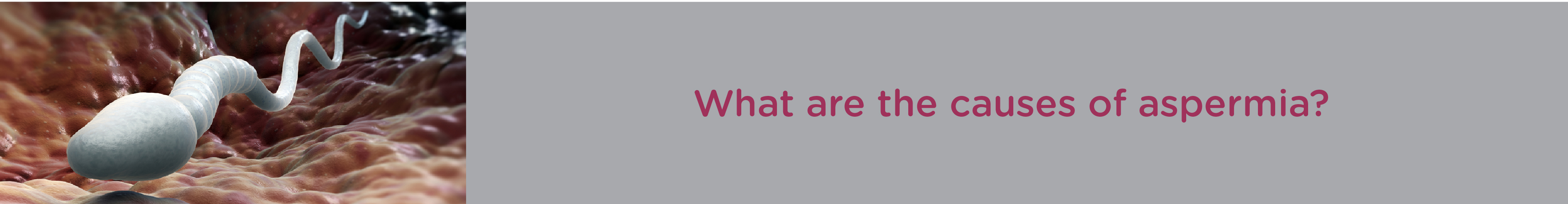 What are the Causes of Aspermia?