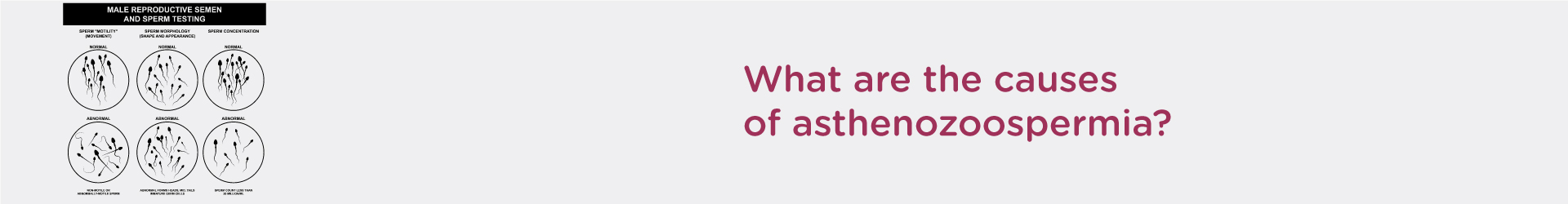 What are the Causes of Asthenozoospermia?