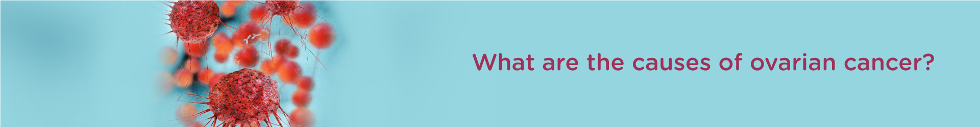 The Causes of Ovarian Cancer