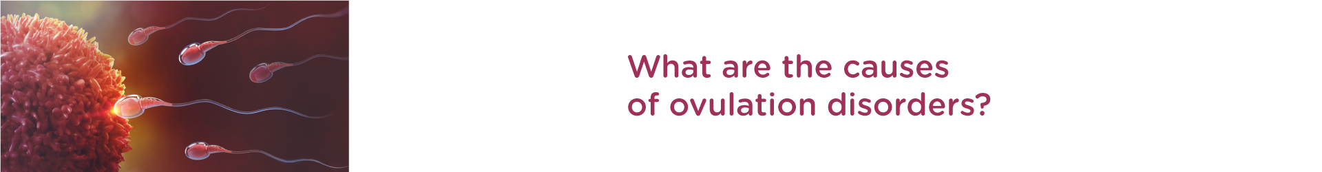 What are the causes of ovulation disorders?