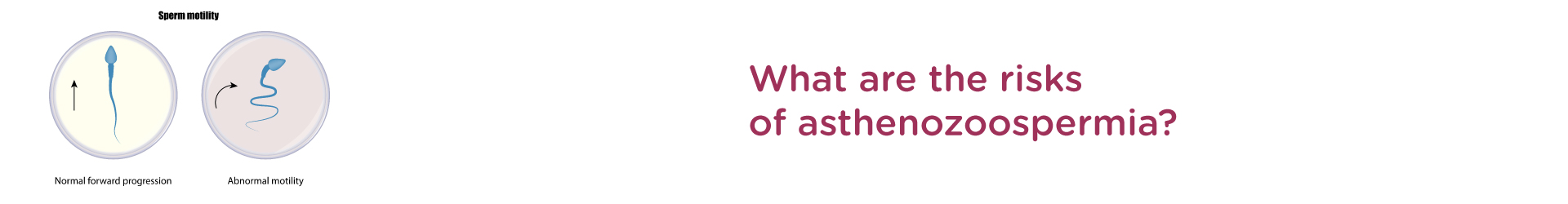 What are the Risks of Asthenozoospermia?