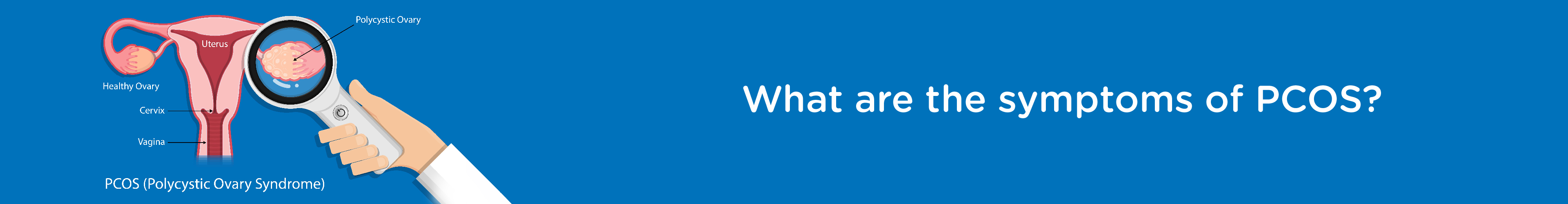 What are the symptoms of PCOS?