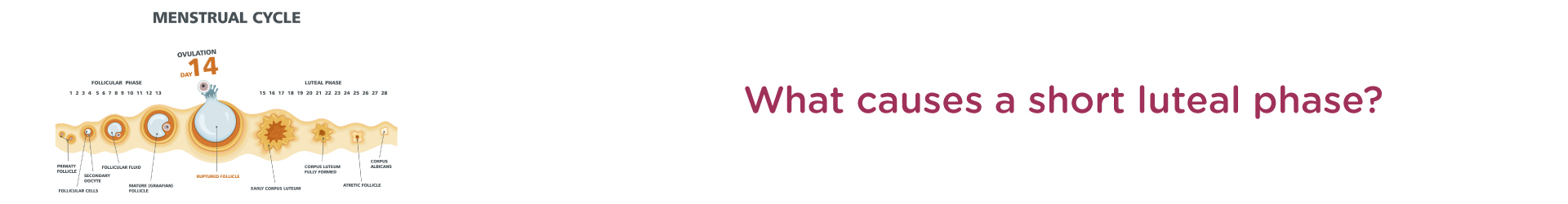 What causes a short luteal phase?