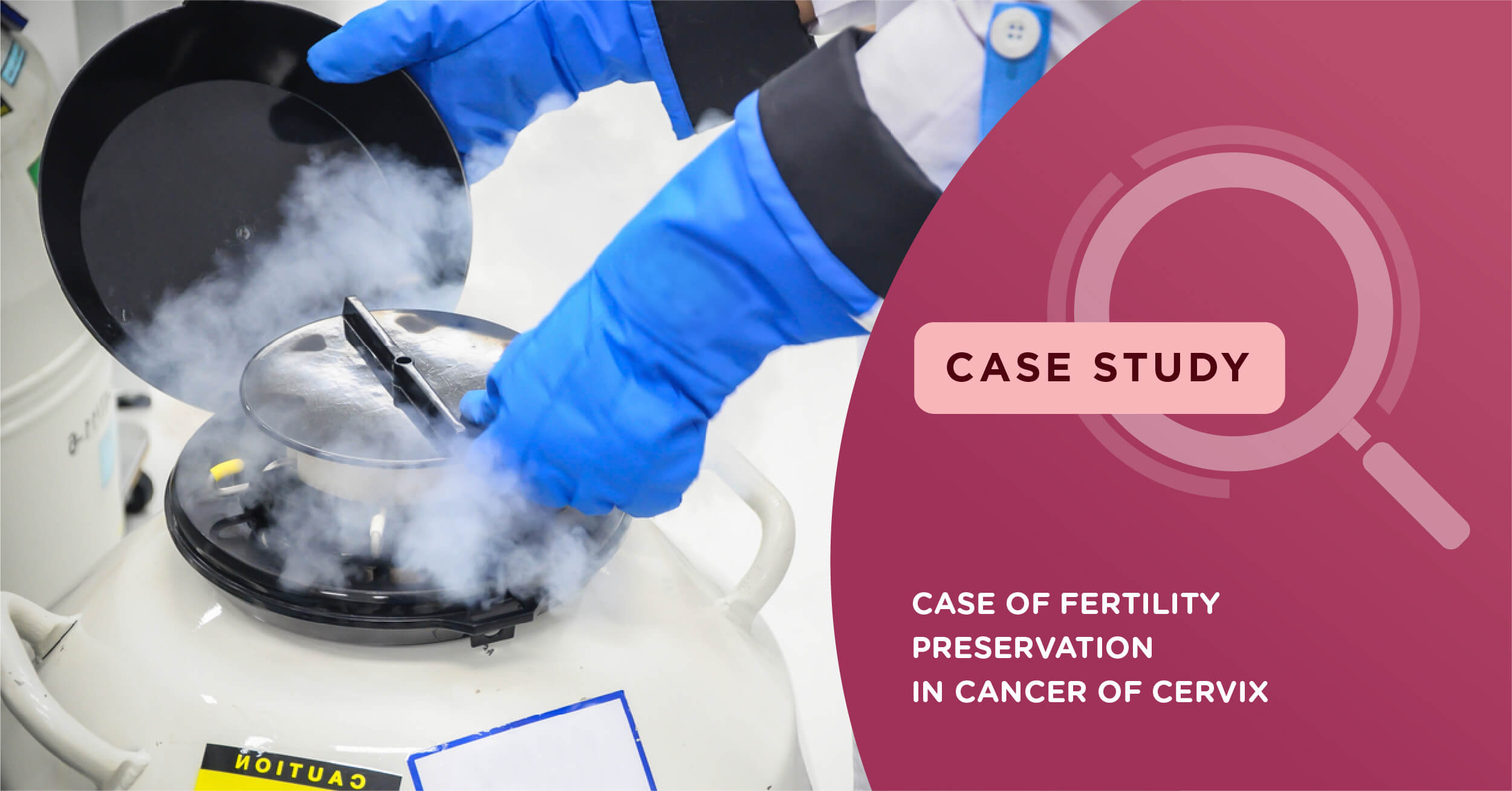 Dr. Richa Jagtap helps couple get a chance at parenthood, overcoming cervical adenocarcinoma!