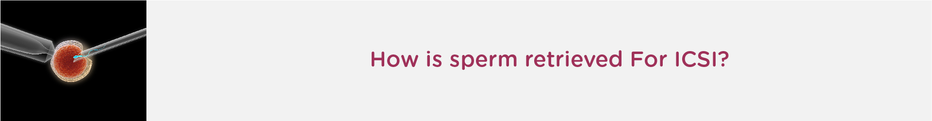 How Is Sperm Retrieved for ICSI?
