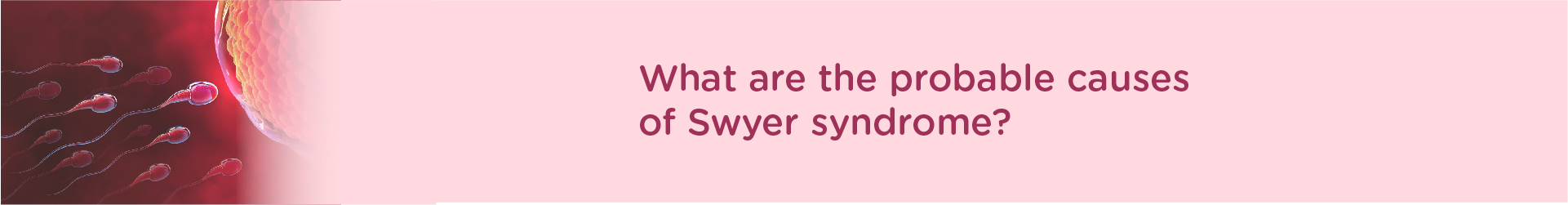What Is A Swyer Syndrome?